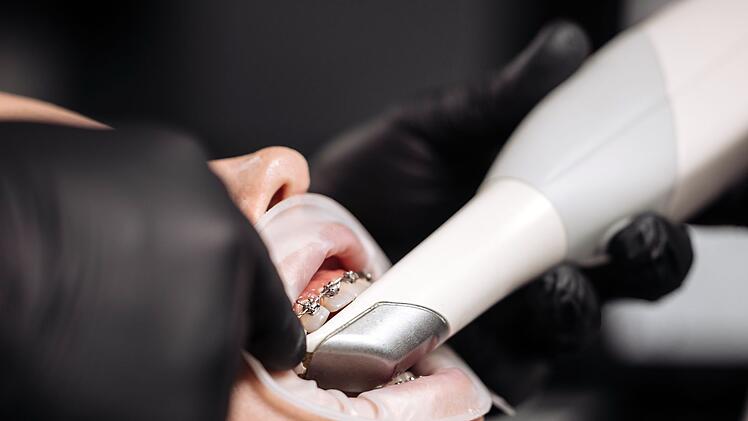 Durch Regulierungen und regelmäßige Kontrolle können Zahnfehlstellungen wieder behoben werden.