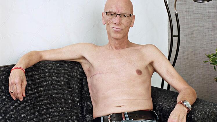 Für eine Serie porträtierte die niederländische Fotografin Suzanne Reitsma Männer nach einer Brust-Operation. Das Bild zeigt Erwin. Er starb am 1. Januar 2015 an seiner Erkrankung, gerade einmal 45 Jahre alt. Foto: Suzanne Reitsma