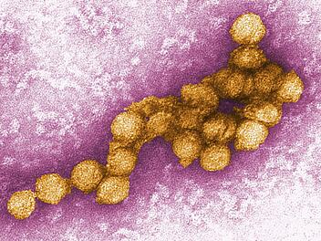 West-Nil-Virus in Franken nachgewiesen