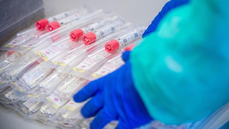 Vom 13. September bis vorgestern sind allein in der Corona-Abstrichstelle in der Kulmbacher Flessastraße 1559 Speicheltests genommen worden.  Symbolfoto: Jens Büttner/dpa