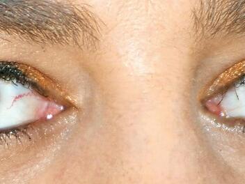 Diese Augen sollen in die Zukunft sehen, sagt zumindest die Besitzerin jener abgebildeten Sehorgane.  Fotos: Michael Busch