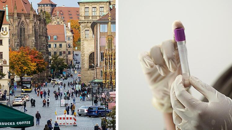 Gefährliche Geschlechtskrankheit greift in Nürnberg um sich - "besonders deutlicher Anstieg"