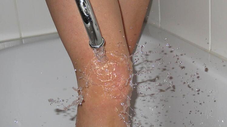 So funktioniert ein Knieguss. Foto: Carmen Schwind