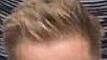 SteffenDeringer
