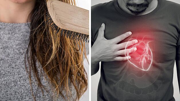 Haare könnten zeigen, ob du später Herzprobleme bekommst