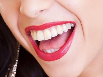 Das perfekte Lachen kann durch Karies schnell dahin sein. Umso besser, wenn die Zähne bald von selbst nachwachsen könnten. Symbolbild: Claudio_Scott/pixabay.com
