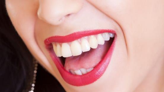 Das perfekte Lachen kann durch Karies schnell dahin sein. Umso besser, wenn die Zähne bald von selbst nachwachsen könnten. Symbolbild: Claudio_Scott/pixabay.com