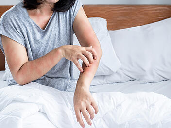 Hausstaub-Allergie erkennen: Das sind typische Symptome