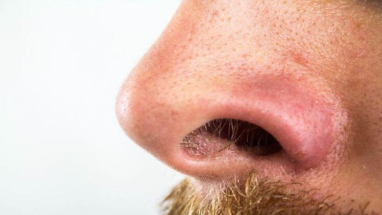 Einem HNO-Arzt zufolge kann das Zupfen von Nasenhaaren tödlich ausgehen. Symbolbild: pixabay.com/derneuemann