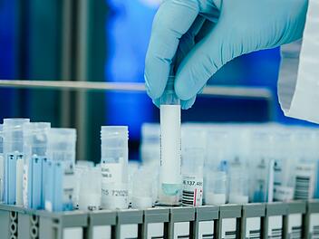 Medizinstatistiker fordert großangelegte Studie: "Zahlen sind dramatisch falsch"