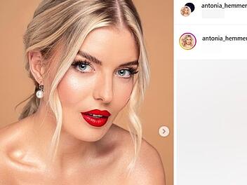 Oberfränkischer Realitystar macht chronische Krankheit öffentlich