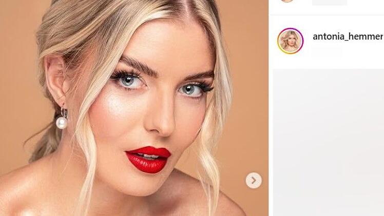 Oberfränkischer Realitystar macht chronische Krankheit öffentlich