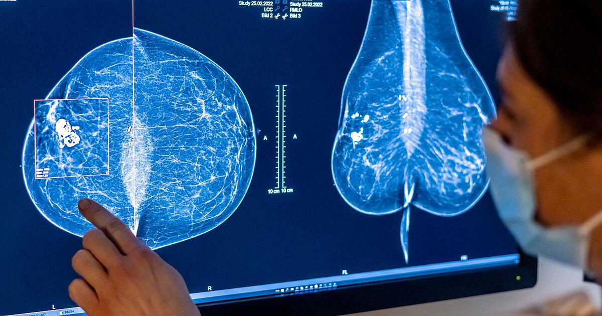 RKI-Fast-jeder-zweite-Deutsche-erkrankt-an-Krebs