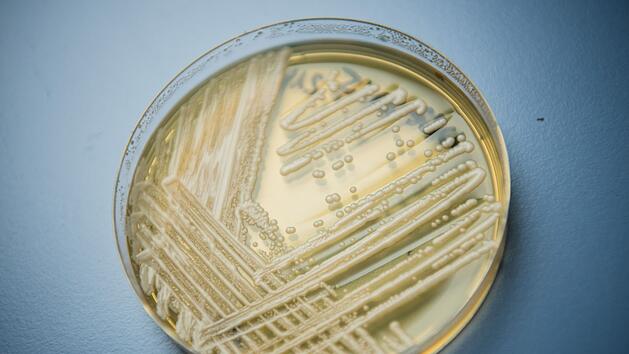 Candida auris: Pilz breitet sich "dramatisch" aus