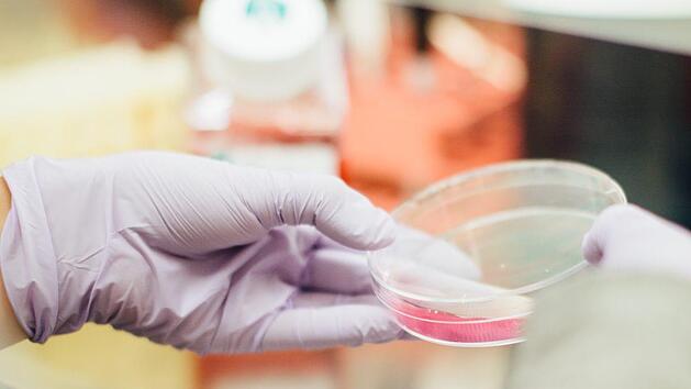 Makrophagen erledigen in gesunden Geweben wichtige Aufgaben, k&ouml;nnen bei Infektionen aber auch auf Angriff gehen. Foto: Drew Hays/ Unsplash