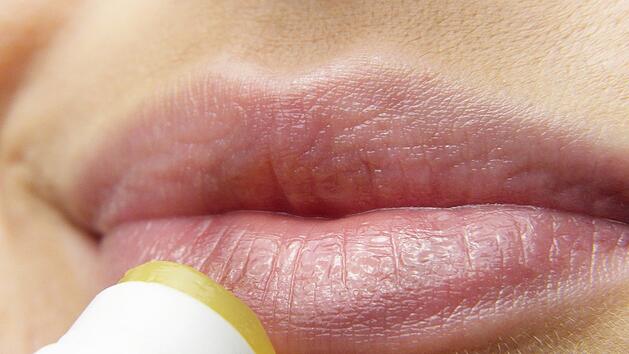 Humane Herpesviren können schmerzhafte Infektionen an den Lippen verursachen.