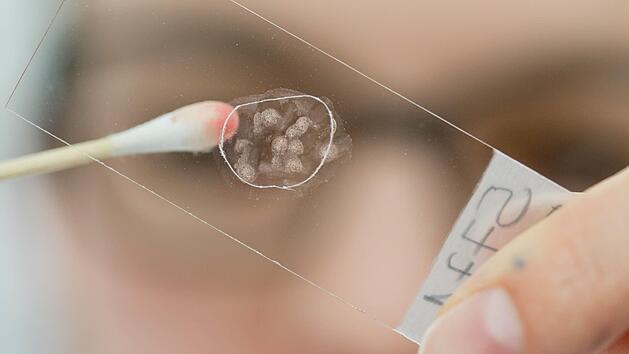 Multiresistente Keime k&ouml;nnen insbesondere in Krankenh&auml;usern und Pflegeheimen zum Problem werden. Foto: Daniel Karmann/dpa