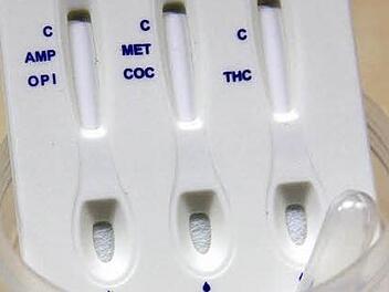 Für den Drogenvortest muss Urin in einen kleinen Becher abgegeben werden. Mit einer Pipette wird die Flüssigkeit dann auf die Testbereiche aufgebracht. Die drei Felder sprechen auf unterschiedliche Rauschgifte an. Foto: Marco Meißner