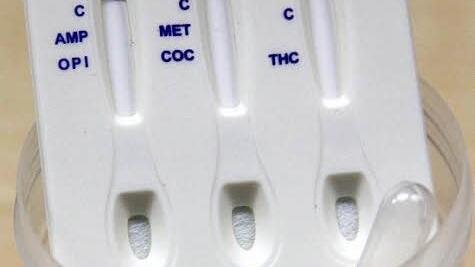 Für den Drogenvortest muss Urin in einen kleinen Becher abgegeben werden. Mit einer Pipette wird die Flüssigkeit dann auf die Testbereiche aufgebracht. Die drei Felder sprechen auf unterschiedliche Rauschgifte an. Foto: Marco Meißner