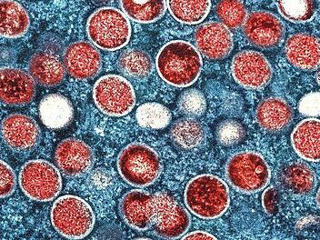 Eine kolorierte Aufnahme von Partikeln des Affenpockenvirus (rot) in einer infizierten Zelle (blau), die im Labor gezüchtet und in der Niaid Integrated Research Facility in den USA aufgenommen wurde.