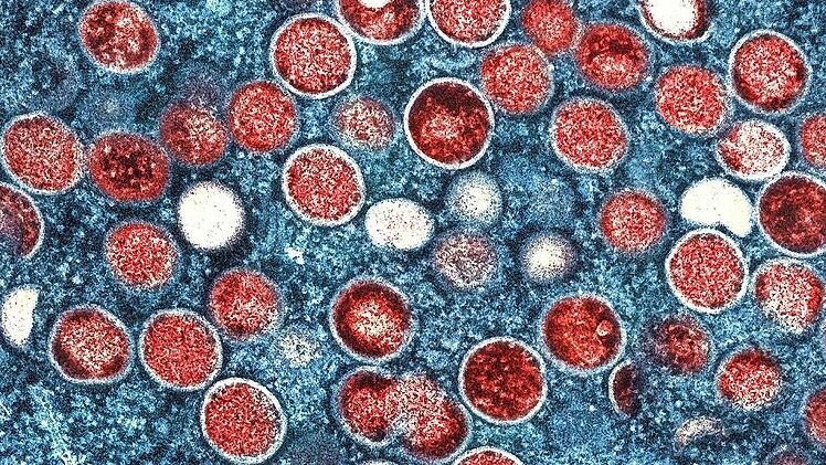 Eine kolorierte Aufnahme von Partikeln des Affenpockenvirus (rot) in einer infizierten Zelle (blau), die im Labor gezüchtet und in der Niaid Integrated Research Facility in den USA aufgenommen wurde.