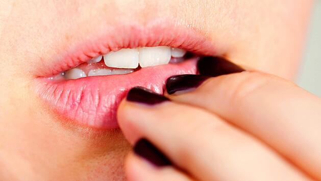 Aphthen sind schmerzhafte Bläschen im Mund und an den Lippen, die meist nach wenigen Tagen wieder verheilen. Foto: Mascha Brichta/dpa