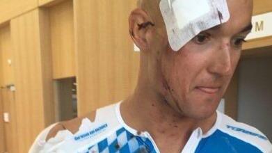 Dieses Bild postete Andreas Dreitz nach seinem Krankenhausbesuch. Es zeigt ihn mit einem dicken Pflaster auf der Stirn, verbundenen Unterarmen und zerrissenem Trikot. Sein Kommentar mit einem Dank für alle Mitteilungen und Genesungswünsche lautete: "Nur ein paar Stiche und Kratzer. Ich werde zurückkommen." Foto: pr