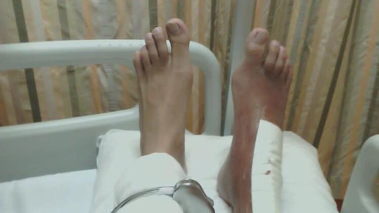 Im Krankenhaus nach der OP.