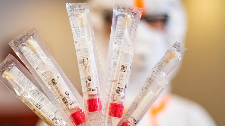 Corona-Tests sind ebenso wichtig wie schwer zu beschaffen.  Foto: Jonas Güttler/dpa