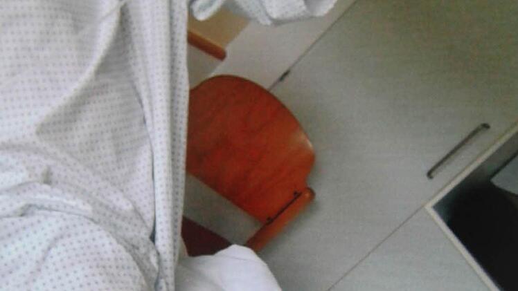 Die Bisse waren tiefer, so dass das Opfer mehrmals operiert werden musste. Foto: privat