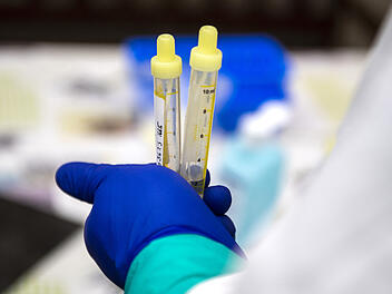 Coronavirus Testkapazotäten