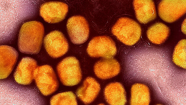 WHO besorgt &uuml;ber neue Variante des Mpox-Virus