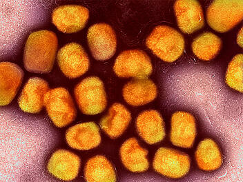 WHO besorgt über neue Variante des Mpox-Virus