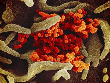 Seit drei Tagen liegt die 7-Tage-Inzidenz im Landkreis Bad Kissingen &uuml;ber dem Grenzwert von 100. Darauf muss der Landkreis mit weiteren Einschr&auml;nkungen reagieren.  Foto: Uncredited/NIAID-RML/AP/dpa