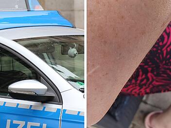 Neustadt bei Coburg: Mitarbeiterin schildert wilde Beißattacke durch Ladendiebin - "kaum zu bändigen"