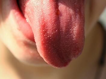 Heftiger Streit in Rostock: Eine Frau hat ihrem Partner ein St&uuml;ck der Zungenspitze abgebissen. Symbolfoto: Pixabay