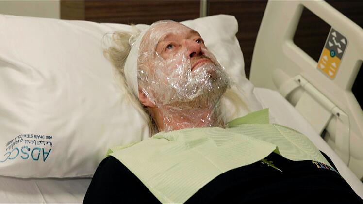 Robert Geiss unterzieht sich einem sogenannten Vampirlifting.