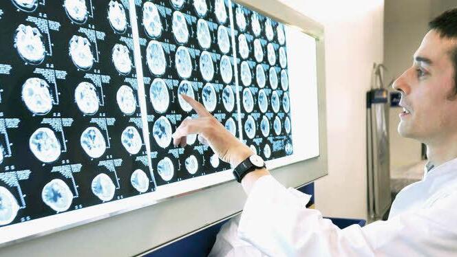 Eine massive Hirnschädigung, etwa eine schwere Kopfverletzung oder Hirnblutung, kann trotz aller medizinischen Maßnahmen zum Tod des Patienten führen. Die zweifelsfreie Feststellung des Todes durch die Feststellung des endgültigen, nicht behebbaren Ausfalls der Gesamtfunktion des Großhirns, des Kleinhirns und des Hirnstamms ist neben der Zustimmung zur Organspende die wichtigste Voraussetzung für eine Organspende. Die Diagnostik muss nach den Richtlinien der Bundesärztekammer durchgeführt wer...