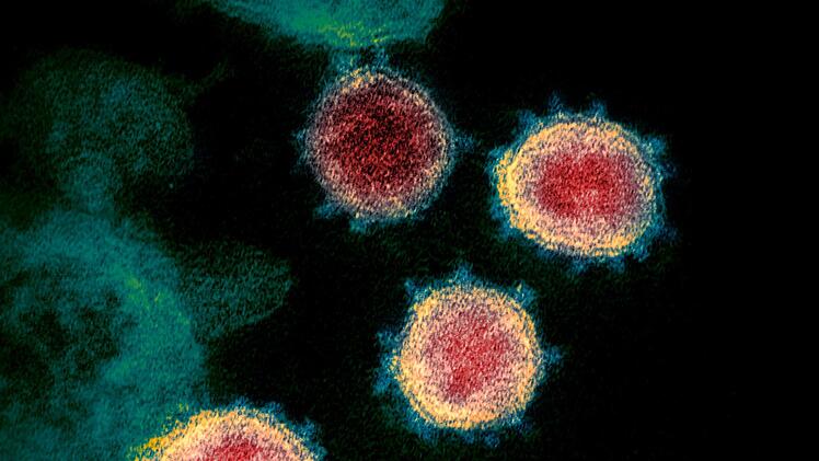 Corona hat unser alltäglicher Leben massiv verändert: Diese elektronenmikroskopische Aufnahme, die von den U.S. National Institutes of Health im zur Verfügung gestellt wurde, zeigt das neuartige Coronavirus (SARS-CoV-2), das Covid-19 verursacht. Foto: NIAID-RML/AP/dpa
