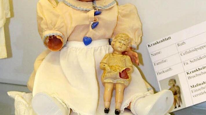 Arm gebrochen: Die Diagnose ist klar, doch über die richtige Restaurierungsmethode diskutieren die Experten noch. Wer möchte, kann die Reparatur der infolge des Brands beschädigten Puppen unterstützen.