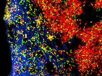 Würzburg: Immunzellen im Gänsemarsch unterwegs - Immunologie findet für Krebstherapie wichtigen Befund Würzburg: Immunzellen im Gänsemarsch unterwegs - Immunologie findet für Krebstherapie wichtigen Befund