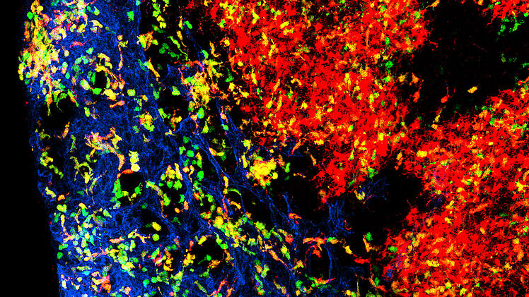 W&uuml;rzburg: Immunzellen im G&auml;nsemarsch unterwegs - Immunologie findet f&uuml;r Krebstherapie wichtigen Befund