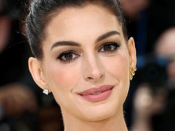 Schauspielerin Anne Hathaway hat im Podcast "Popcast" &uuml;ber eine zur&uuml;ckliegende Erkrankung ihrer Augen gesprochen.