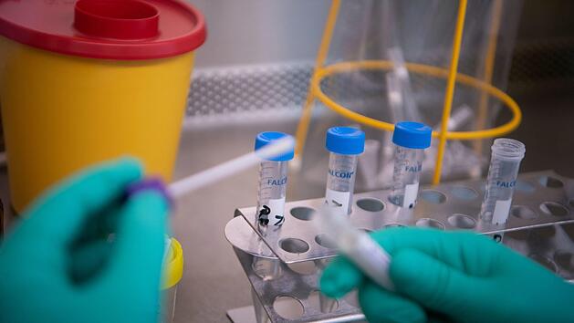 In Frankreich wächst die Sorge um die Infizierten mit dem neuartigen Coronavirus: Bei einem Patienten hat sich der Zustand verschlechtert, bei einem weiteren sei die Lage laut Gesundheitsministerium ernst. Foto: Marijan Murat/dpa