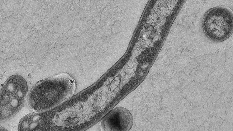 Ein Mitarbeiter des Uniklinikums in Würzburg wird verdächtigt, mehrere Patienten mit Tuberkulose infiziert zu haben. Das Tuberkulose-Bakterium gilt als gefährlich . Foto: Robert-Koch-Institut/Gudrun Holland