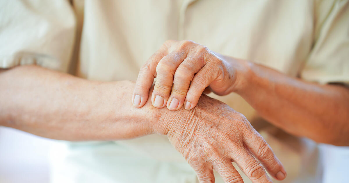 Kurkuma & Co.: Welche Gewürze gegen Arthrose-Beschwerden helfen