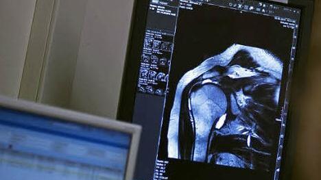 Bildgebende Verfahren wie Ultraschall oder diese Darstellung aus dem Magnet-Resonanz-Tomographen (MRT) helfen bei der Diagnose.
