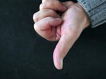 Daumen-Stück bei Streit in Erlangen abgebissen Daumen-Stück bei Streit in Erlangen abgebissen