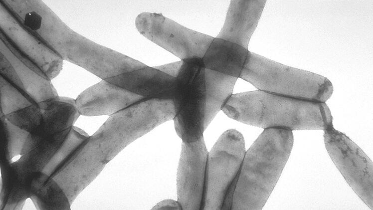 Legionella pneumophila - klein und gefährlich für den Menschen.