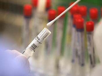 Ein Abstrich wird in einem Labor auf das Coronavirus untersucht